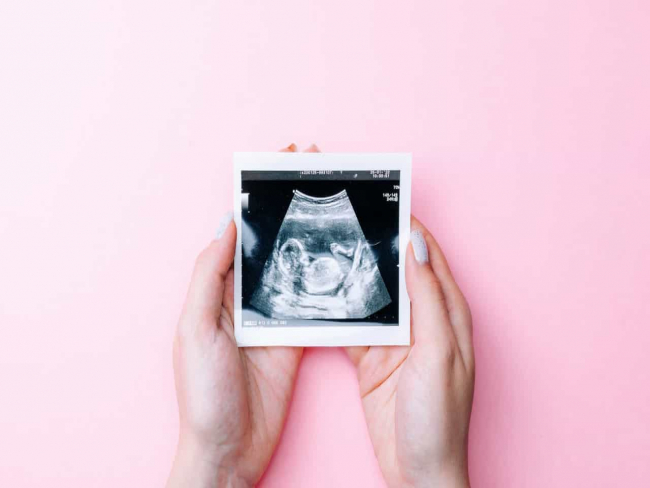 Cientistas criam 'adesivo' que permite a grávidas ver o bebé no telemóvel